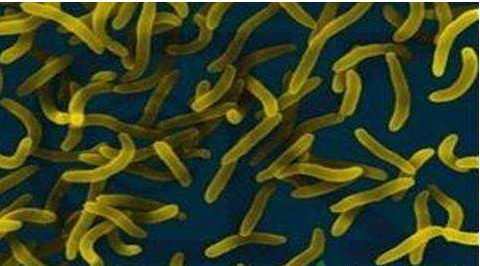 微生物菌劑好？好在哪里您知道嗎？